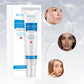 Acne Cream Facial